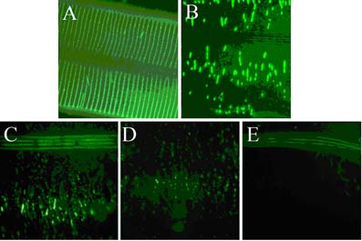 Collagen Genes