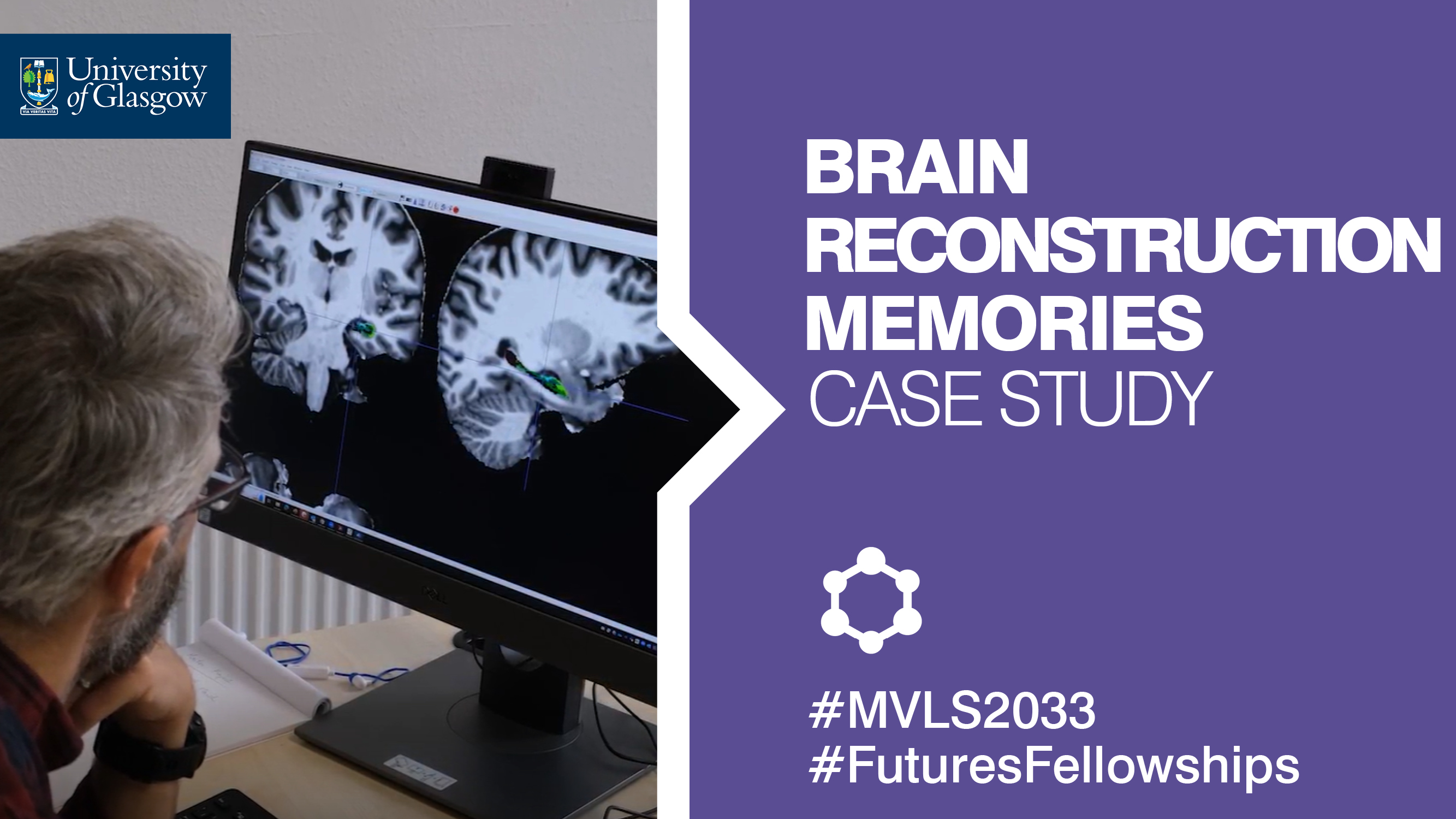 Fundamentals of Life Research Case Study Brain Reconstruction Memories Video Thumbnail