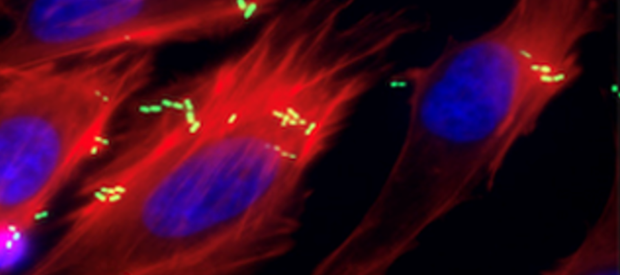 Attachment of enterohaemorrhagic E. coli (EHEC, green) to host cells (blue for the nucleus and red for the cytoskeleton) is reduced when the regulator pdhR is deleted.