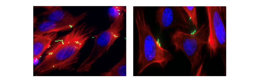 Attachment of enterohaemorrhagic E. coli (EHEC, green) to host cells (blue for the nucleus and red for the cytoskeleton) is reduced when the regulator pdhR is deleted.