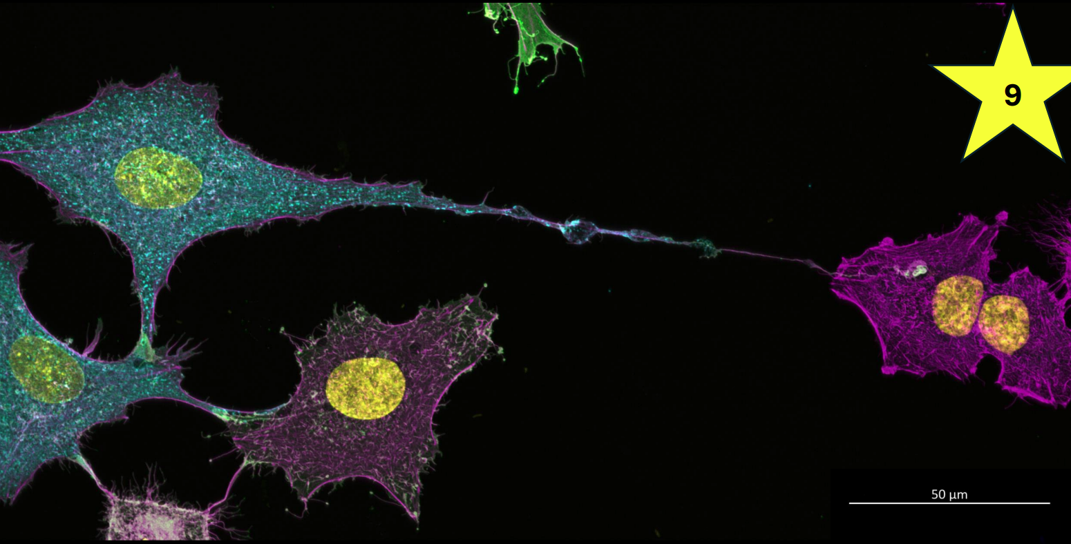 Fluorescent microscopy image of five cells stained in distinct colors: three blue with yellow nuclei, one green, and one purple with two yellow nuclei. A long filament connects the blue and purple cells.
